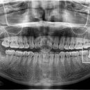 더바른윤치과의원 이미지