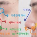 플레저성형외과의원 이미지