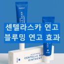 태극한의원 | 글루밍 연고 비립종 연고 센텔라스카 연고 사용 후기와 효과