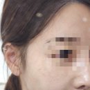 예쁨주의네일&피부 | 예쁨주의쁨 강남 필로드 피부스킨부스터 리얼후기, 프리미엄 공간에서 경험한 피부변화