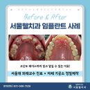다산치과기공소 이미지
