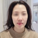 용인 수지피부관리 르영에스테틱 에너지테라피 윤곽관리