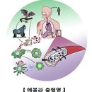 에볼라 출혈열 (Ebola hemorrhagic fever) 이미지