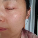 (주)플러스라인 | 비자극케어, 리베스킨 에피덤플러스 라인 세트 2주 사용 후기