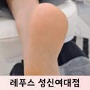 레푸스 성신여대점 | 성신여대발각질 고민 끝 레푸스 성신여대점에서 아기 발 된 후기