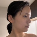 뉴코어 | 뉴비쥬와 코어톡스, 뉴코어시술로 이중턱과 얼굴라인 달라진 후기