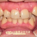 서울롱치과교정과치과의원 이미지
