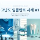 허메디칼의원 | 광주 고난도 임플란트, 앞니 수술 후 즉시 보철로 성공한 실제 사례 #1