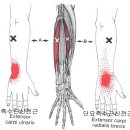 나는 골프만 치는데.. 왜 때문에 테니스 엘보?? 이미지