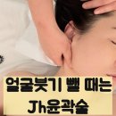 지오 | 얼굴붓기 빼기, Jh윤곽술 관리 지오테라피 에스테틱샵 후기