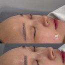 [공지] 양산 모공 에스테틱피부관리 &#39;올가드림뷰티&#39;이지더원5차점