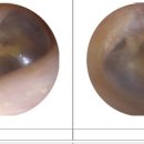 효자보청기 이미지