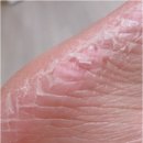 닥터공감 | 닥터원더악어발팩 내돈내산 후기 팩폭주의