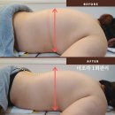 더조각테라피 이미지