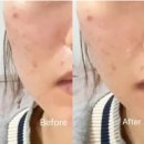 (주)비젼 | 셀비젼 쎄라쥬 내돈내산 고민 중이라면? 쎄라쥬 2달 솔직 후기 홈케어 디바이스 최저가 구매방법 알려...
