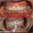 심미치과기공소 이미지