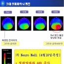 뉴로메디주