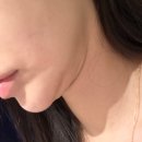캔호텔 | 요즘 핫한 AI울쎄라 메타스캔 V&amp;MJ피부과 수면 후기!
