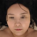 평택 고덕 웨딩관리 피부전문 윤곽관리 전문 &#39;뜰에스테틱 고덕점&#39;