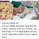 부산 조리원 서 신생아 낙상 '두개골 골절 및 뇌출혈' 이미지