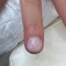 문제성 손, 발 오감네일 이미지