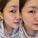 팔자주름·눈가주름 고민이라면? 트루페이스 라인 코렉터