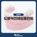 새서울플란트치과의원 | 도봉역전체임플란트, 오래 사용하기 위한 관리방법
