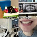 느낌 - 영도구 태종로73번길 14 | 수유 인비절라인 첫 교정 후기｜장치 받으면 이런 느낌! 착용감·앱·어태치먼트 리얼 후기