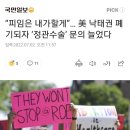 "피임은 내가 할게" … 美 낙태권 폐기되자 ‘정관수술’ 문의 늘었다 이미지