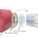 '돌연사 주범' 부정맥 실시간 진단. 치료 전자 패치 개발 이미지