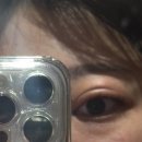 영양중앙초교 | 星空 -1-