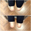 학동사거리 체형교정 필라테스] H7 체형교정 &amp; 필라테스 1:1 레슨 후기 – 교통사고 후 체형 불균형...