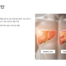 ㈜대웅 | ‘체지방 감소’의 두 얼굴, 간 손상 위험 경고등 켜진 가르시니아