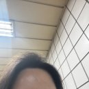 기가차 | 신촌 피부과 한의원 패인흉터 제거 새살침 치료 2회차 후기