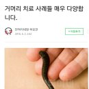 네?? 이렇게 까지 거머리를 붙인다고요?(거머리 치료 사례) 이미지