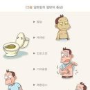 담도암 증상 및 원인 수술 이미지