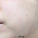 피에이치메디칼 | 닥터랩 마일드피에이치페이셜클렌저 민감성피부를 위한 약산성클렌징폼 추천