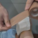 건우약국 | 무지외반증 수술후기 4일차 퇴원!