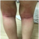 내가본침구