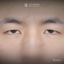 케이스성형외과