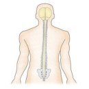 다발성 신경병증 이미지