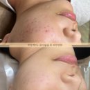 봄에스테틱 이미지