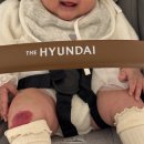 박진소아과의원 | [후기] (딸기) 혈관종을 없애보자.