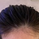 나산센터-3 | 분당두피관리 웰킨두피탈모센터 분당서현점 헤드스파 후기