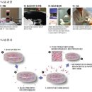 [건대피부과] 비앤씨 피부과(BNC)에서 레이져 4차 시술 받았다!!