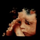 노블클라쎄산부인과의원 | 세종 노블클라쎄 산부인과 : 29주 임산부 입체초음파 보고 온 후기