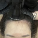 라도헤어뷰티 | [동탄두피] 모발 자라나게 해주는 모발재생술 후기 서헤어