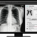 메디우스 이미지