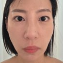 원 에스테틱 | [일산 피부관리] 원에스테틱 후기, 속건조 얼굴 열감 두피 열감까지 꼼꼼하게 봐준 맞춤 케어