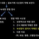 녹내장 전문의가 환자에게 보내는 편지 (9): ‘녹내장 의증이 뭔가요?’ 이미지